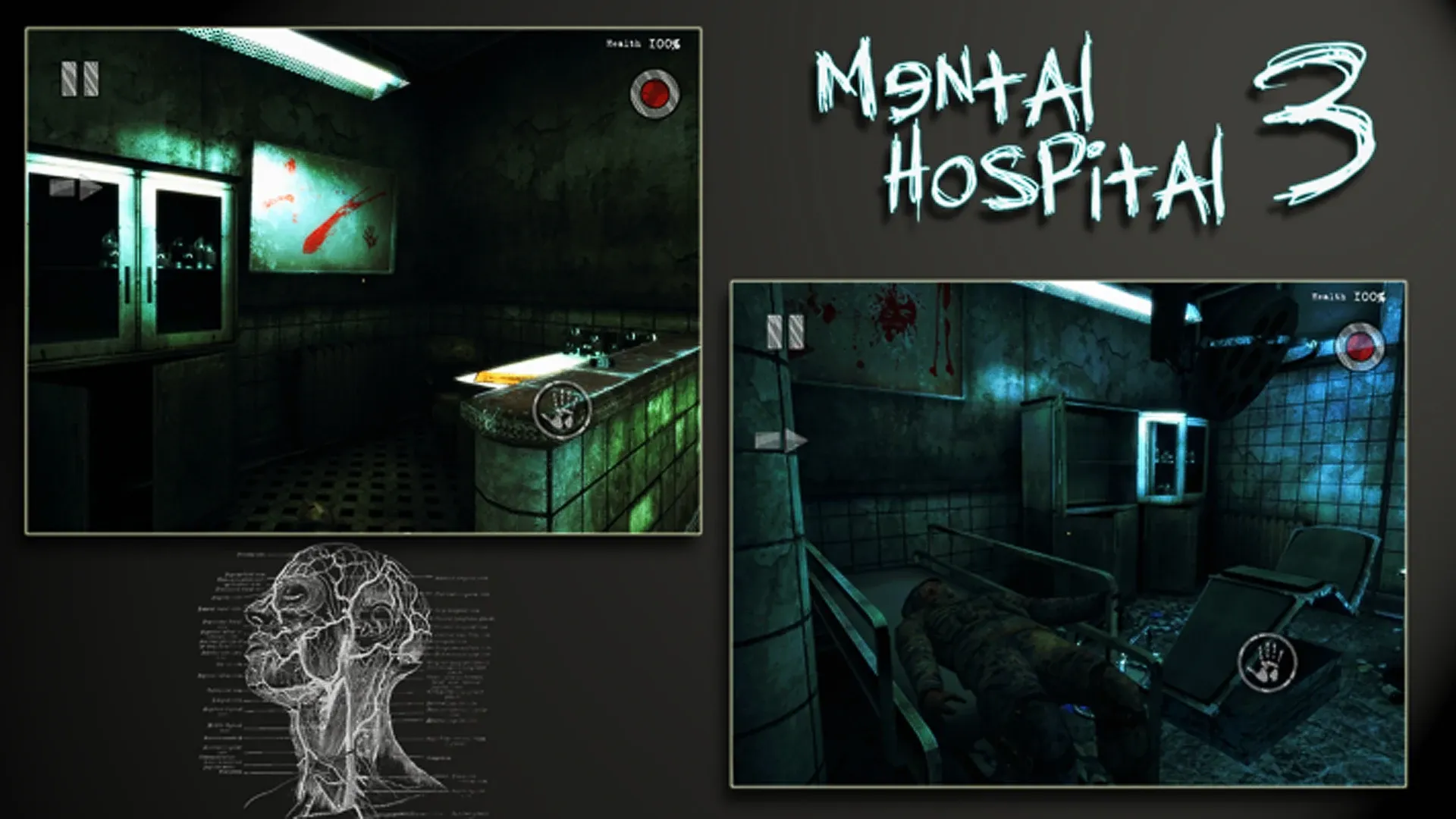 Mental Hospital III Remastered v2.01 APK Мод (Полная версия) Screenshot 1